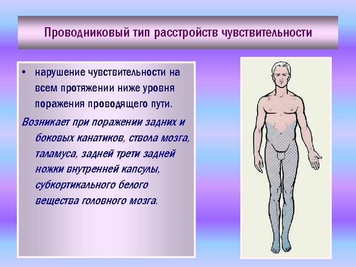 Проводниковый тип расстройств чувствительности • нарушение чувствительности на всем протяжении ниже уровня поражения проводящего