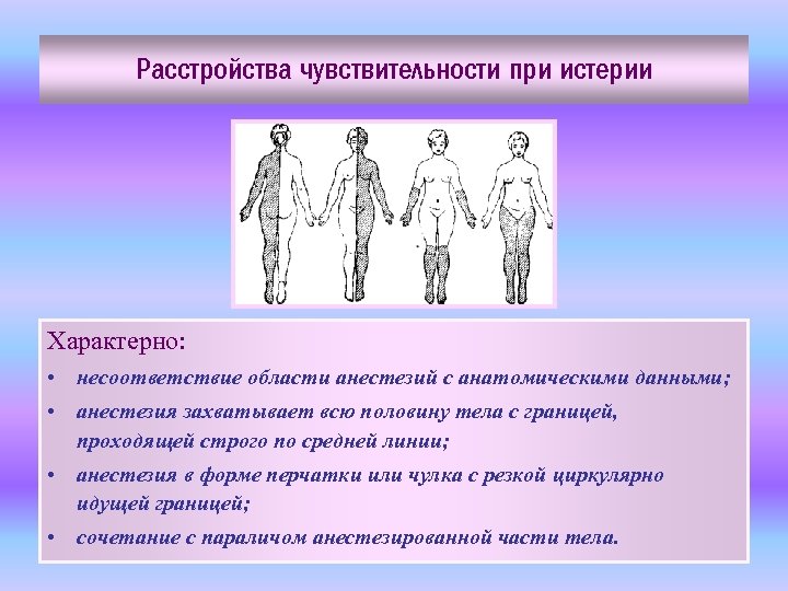 Расстройства чувствительности при истерии Характерно: • несоответствие области анестезий с анатомическими данными; • анестезия