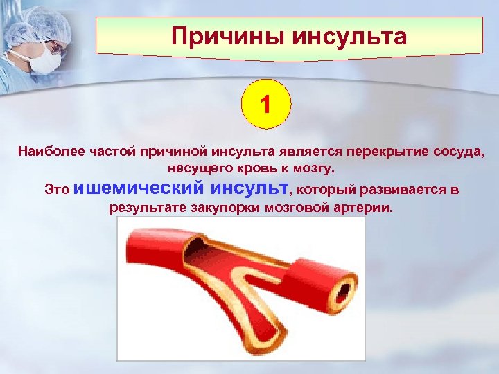 Причины инсульта 1 Наиболее частой причиной инсульта является перекрытие сосуда, несущего кровь к мозгу.