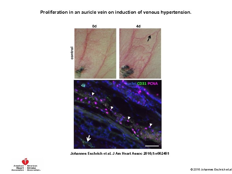 Proliferation in an auricle vein on induction of venous hypertension. Johannes Eschrich et al.