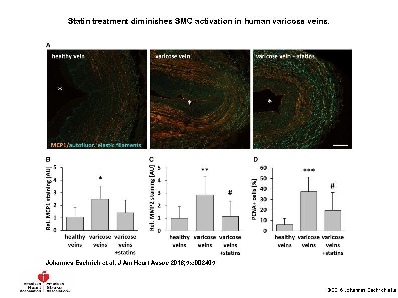 Statin treatment diminishes SMC activation in human varicose veins. Johannes Eschrich et al. J