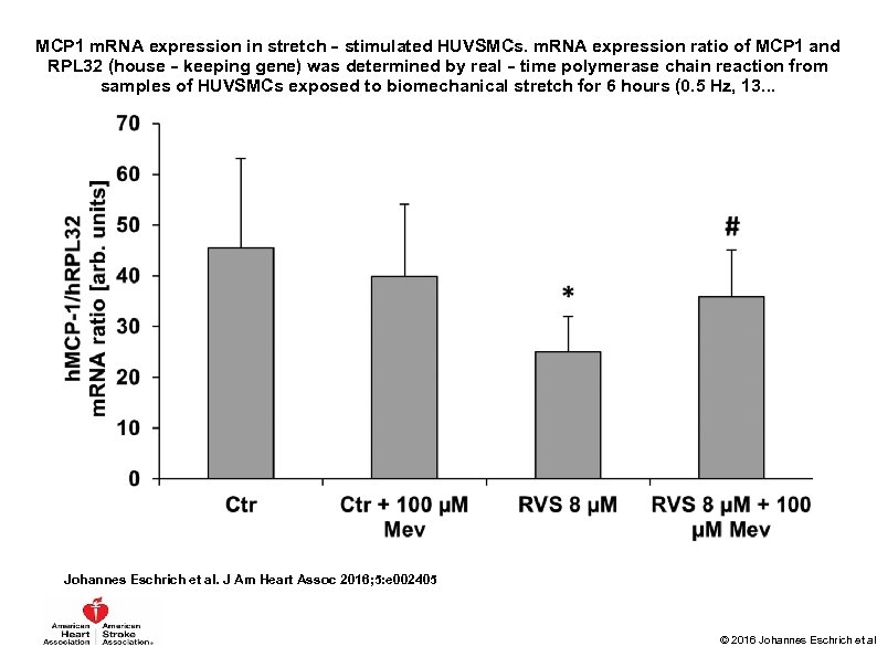 MCP 1 m. RNA expression in stretch‐stimulated HUVSMCs. m. RNA expression ratio of MCP