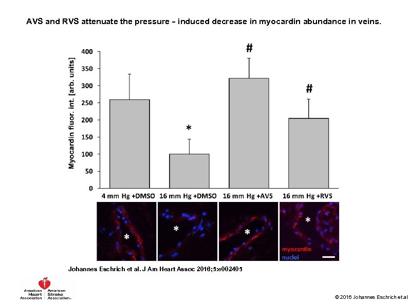 AVS and RVS attenuate the pressure‐induced decrease in myocardin abundance in veins. Johannes Eschrich