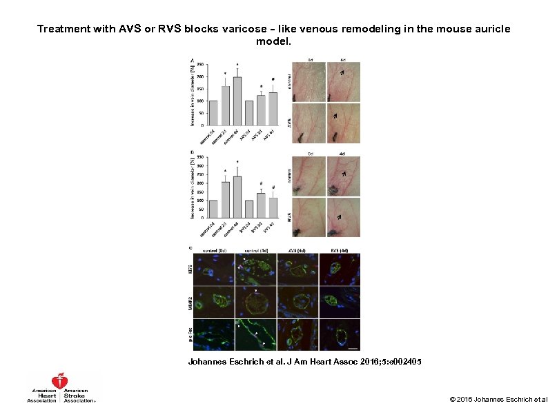 Treatment with AVS or RVS blocks varicose‐like venous remodeling in the mouse auricle model.