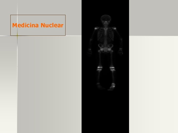 Medicina Nuclear 