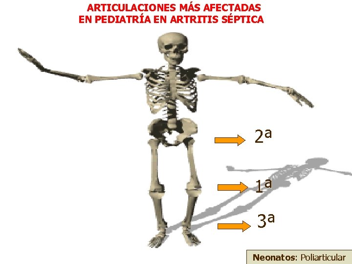 ARTICULACIONES MÁS AFECTADAS EN PEDIATRÍA EN ARTRITIS SÉPTICA 2ª 1ª 3ª Neonatos: Poliarticular 
