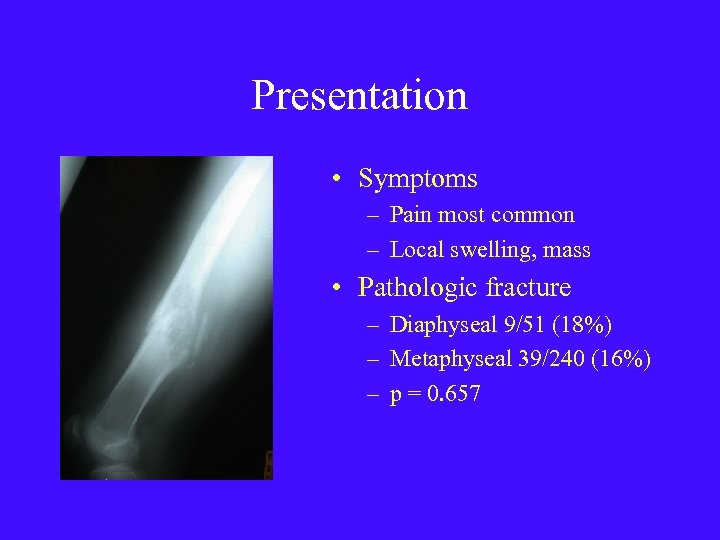 Presentation • Symptoms – Pain most common – Local swelling, mass • Pathologic fracture