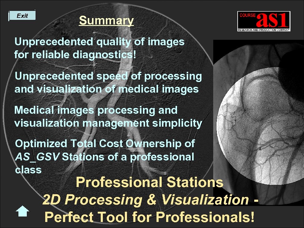 Exit Summary Unprecedented quality of images for reliable diagnostics! Unprecedented speed of processing and