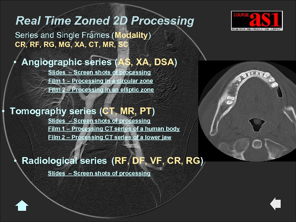 Real Time Zoned 2 D Processing Series and Single Frames (Modality) CR, RF, RG,