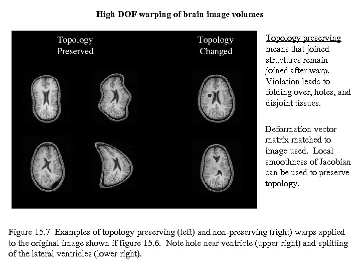 High DOF warping of brain image volumes Topology preserving means that joined structures remain