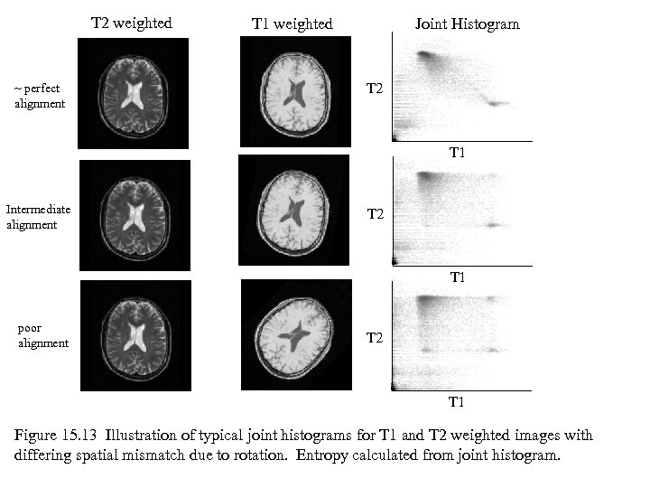T 2 weighted ~ perfect alignment T 1 weighted Joint Histogram T 2 T