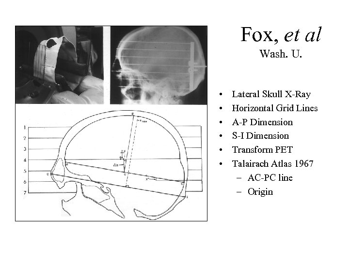 Fox, et al Wash. U. • • • Lateral Skull X-Ray Horizontal Grid Lines