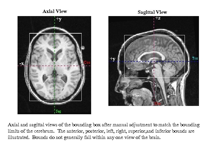 Axial View +y -x Sagittal View +z +y Axial and sagittal views of the