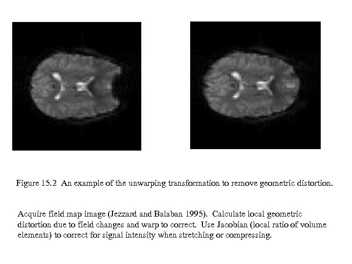 Figure 15. 2 An example of the unwarping transformation to remove geometric distortion. Acquire