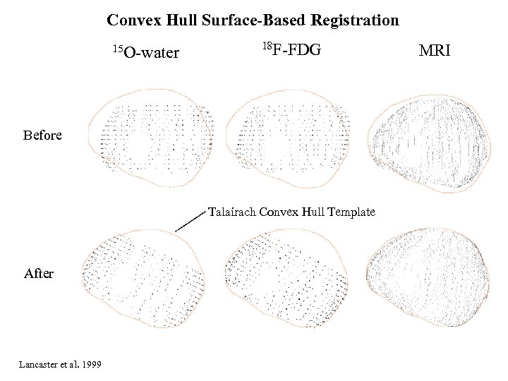 Convex Hull Surface-Based Registration 15 O-water 18 F-FDG Before Talairach Convex Hull Template After