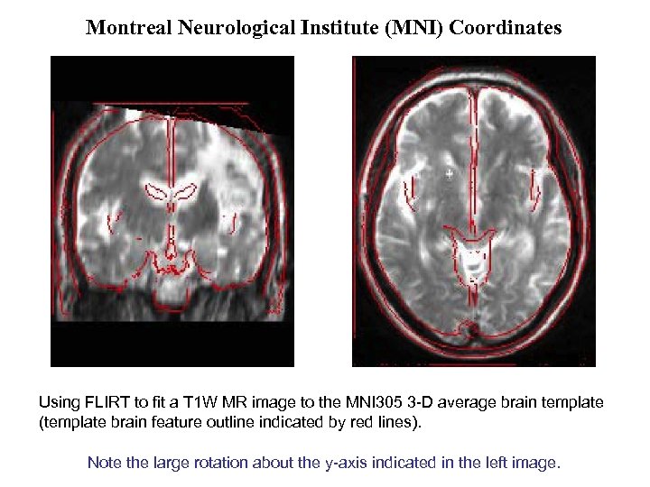 Montreal Neurological Institute (MNI) Coordinates Using FLIRT to fit a T 1 W MR
