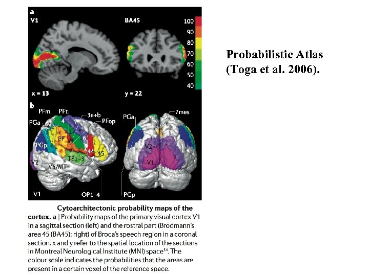 Probabilistic Atlas (Toga et al. 2006). 