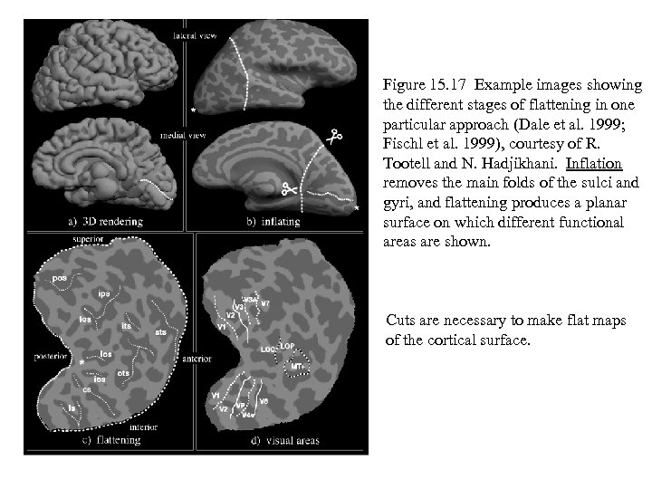 Figure 15. 17 Example images showing the different stages of flattening in one particular