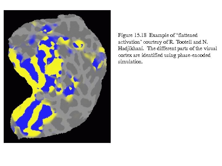 Figure 15. 18 Example of ‘flattened activation’ courtesy of R. Tootell and N. Hadjikhani.