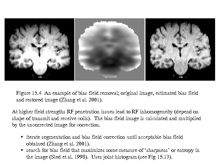 Figure 15. 4 An example of bias field removal; original image, estimated bias field