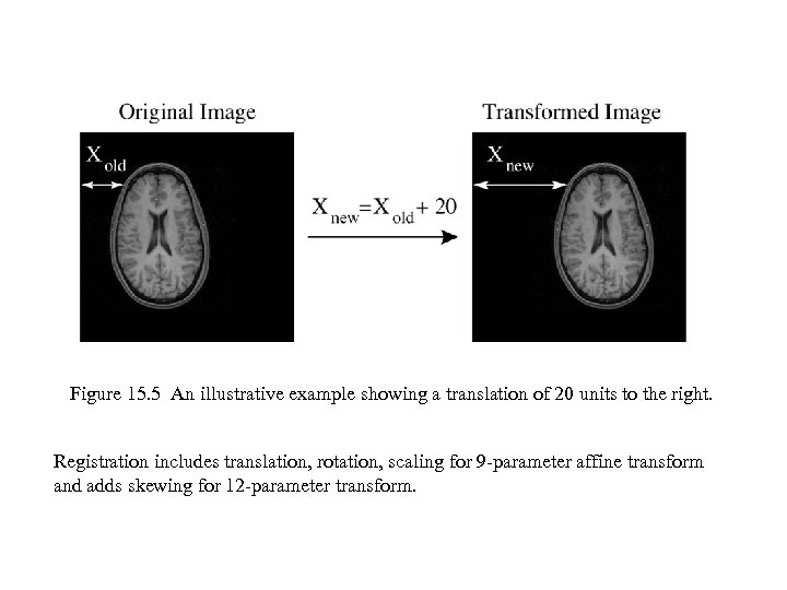 Figure 15. 5 An illustrative example showing a translation of 20 units to the