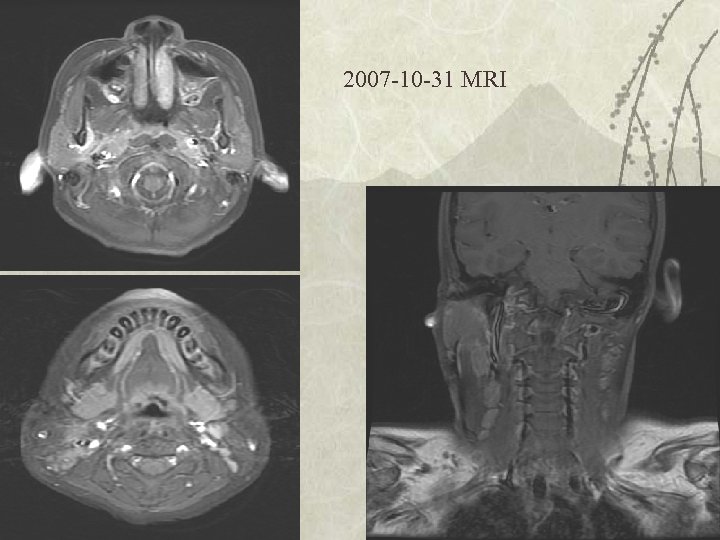 2007 -10 -31 MRI 