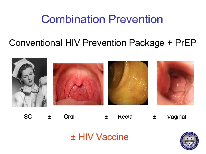 Combination Prevention Conventional HIV Prevention Package + Pr. EP SC ± Oral ± Rectal