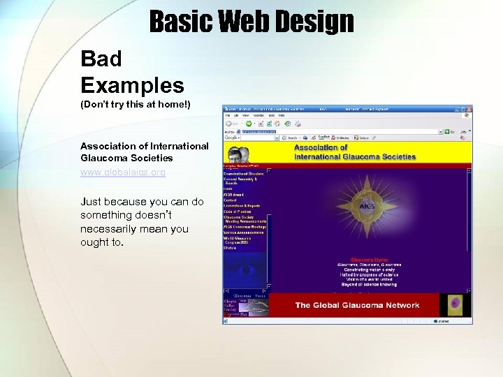 Basic Web Design Bad Examples (Don’t try this at home!) Association of International Glaucoma