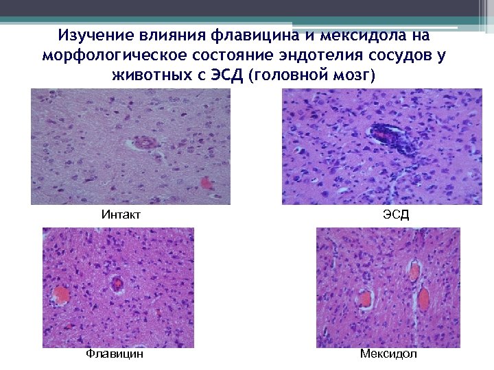 Изучение влияния флавицина и мексидола на морфологическое состояние эндотелия сосудов у животных с ЭСД