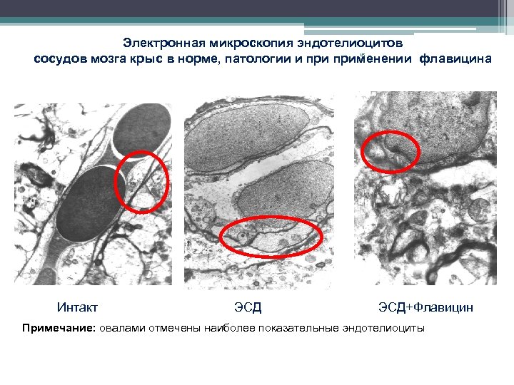 Электронная микроскопия эндотелиоцитов 15 сосудов мозга крыс в норме, патологии и применении флавицина Интакт