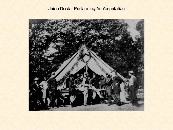 Union Doctor Performing An Amputation 