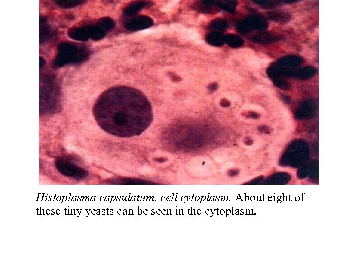 Histoplasma capsulatum, cell cytoplasm. About eight of these tiny yeasts can be seen in