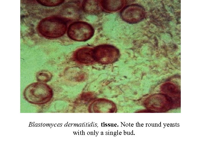 Blastomyces dermatitidis, tissue. Note the round yeasts with only a single bud. 