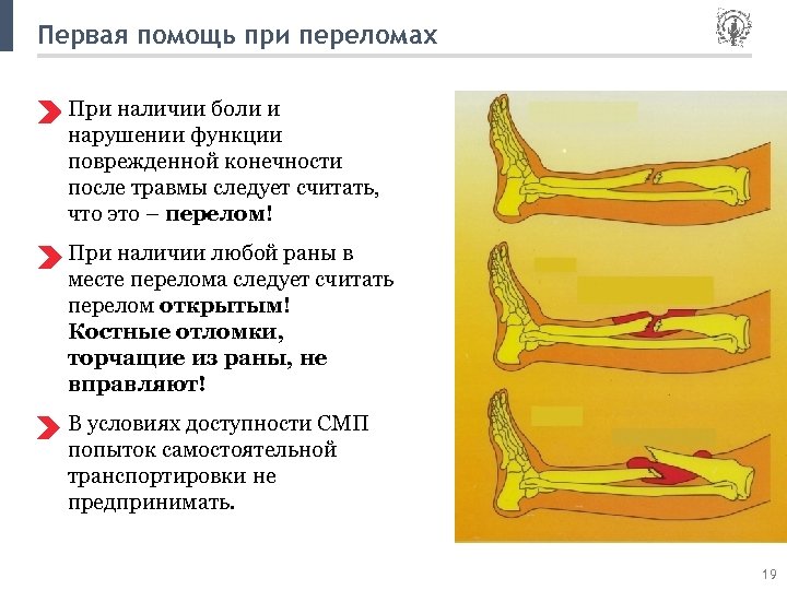 Открытый перелом голени карта смп