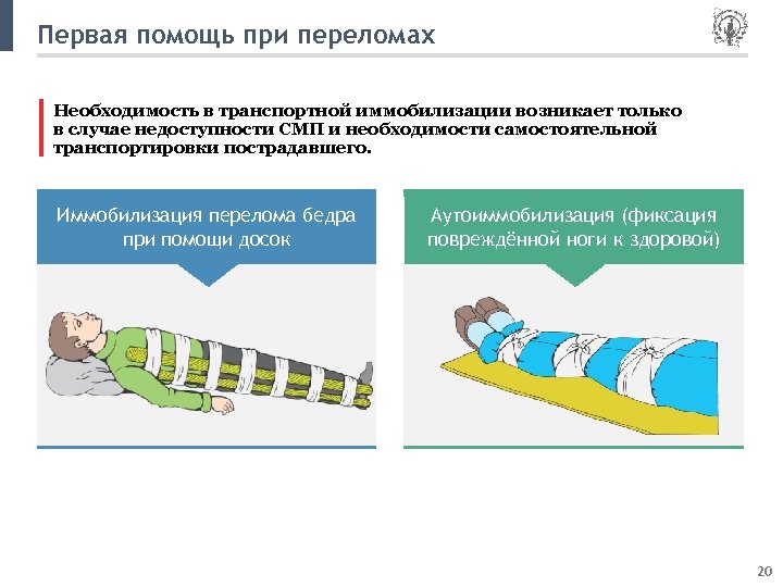 Первая помощь при переломах Необходимость в транспортной иммобилизации возникает только в случае недоступности СМП