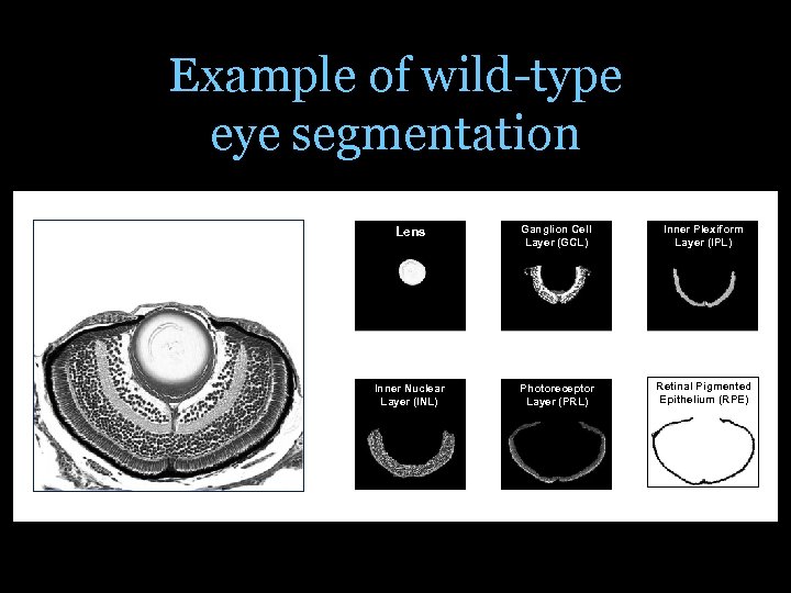 Example of wild-type eye segmentation Lens Ganglion Cell Layer (GCL) Inner Plexiform Layer (IPL)