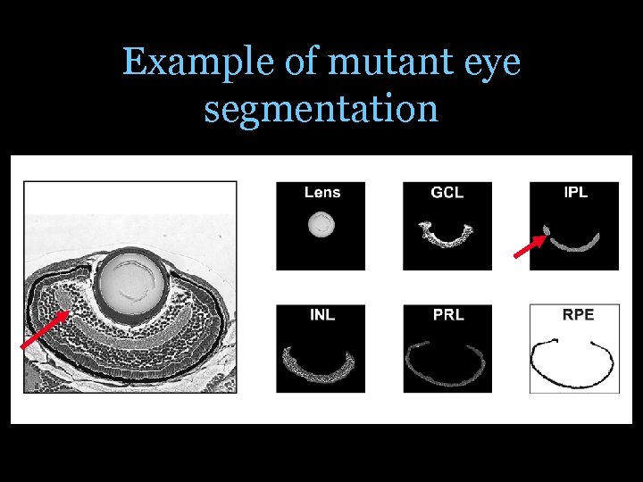 Example of mutant eye segmentation 