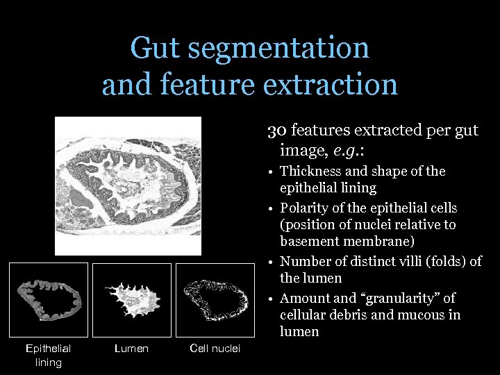 Gut segmentation and feature extraction 30 features extracted per gut image, e. g. :