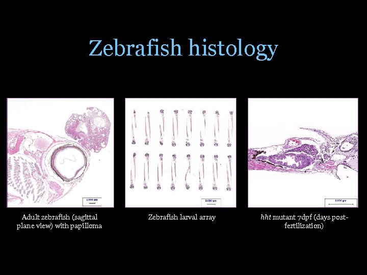 Zebrafish histology Adult zebrafish (sagittal plane view) with papilloma Zebrafish larval array hht mutant