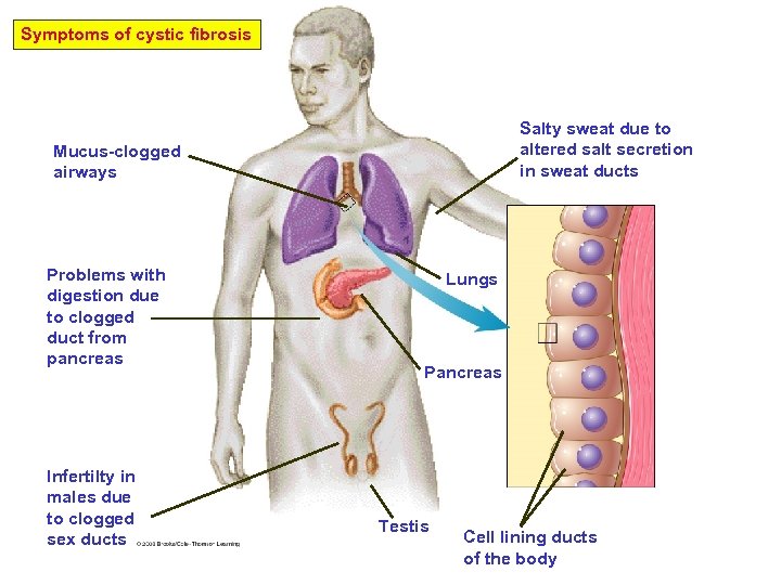 Symptoms of cystic fibrosis Salty sweat due to altered salt secretion in sweat ducts