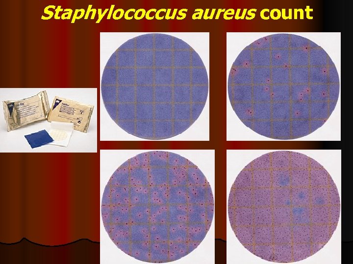 Staphylococcus aureus count 