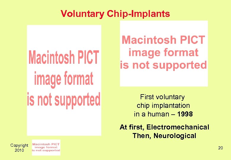 Voluntary Chip-Implants First voluntary chip implantation in a human – 1998 At first, Electromechanical