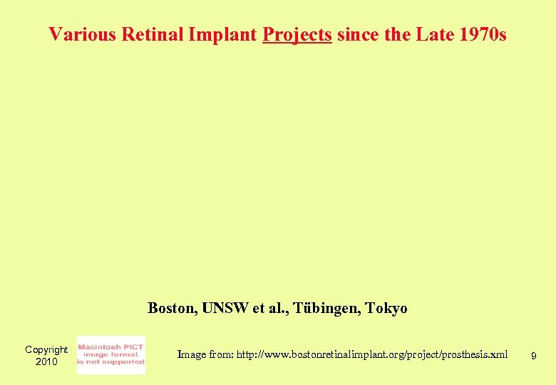 Various Retinal Implant Projects since the Late 1970 s Boston, UNSW et al. ,