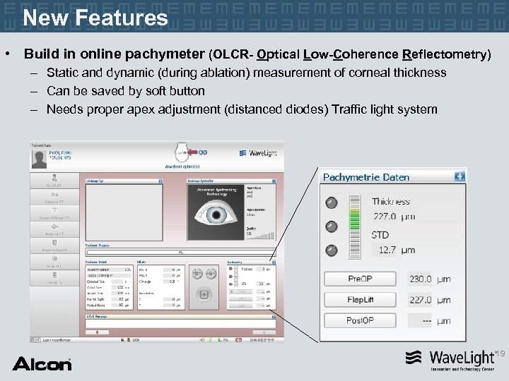 New Features • Build in online pachymeter (OLCR- Optical Low-Coherence Reflectometry) – Static and