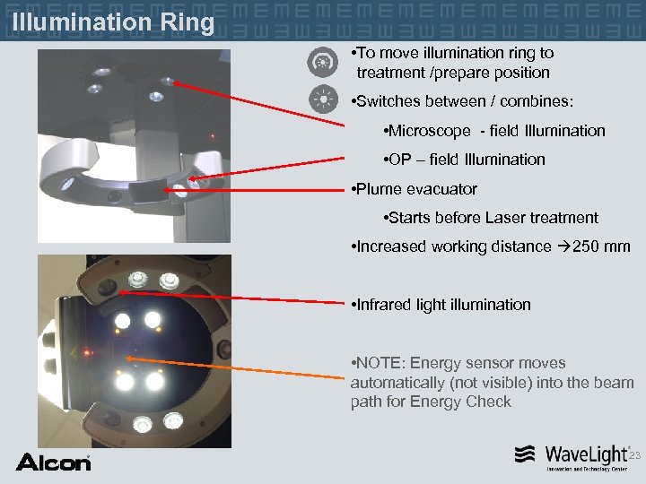 Illumination Ring • To move illumination ring to treatment /prepare position • Switches between