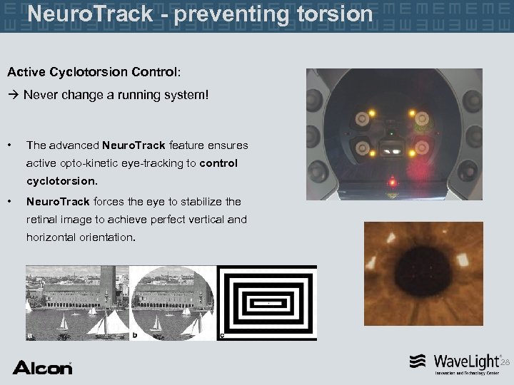 Neuro. Track - preventing torsion Active Cyclotorsion Control: Never change a running system! •