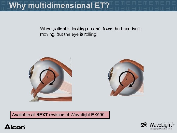 Why multidimensional ET? When patient is looking up and down the head isn’t moving,