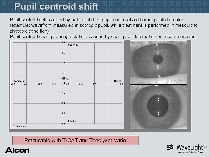 Pupil centroid shift caused by natural shift of pupil centre at a different pupil