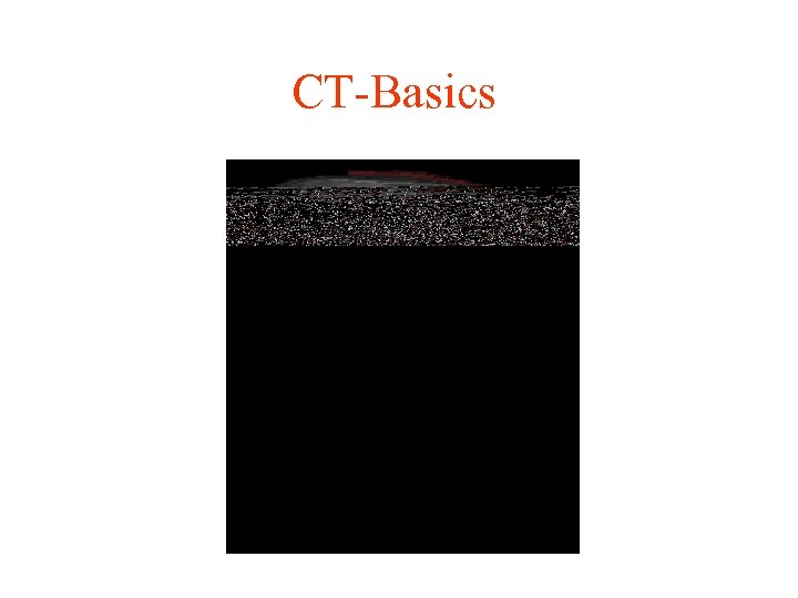 CT-Basics 