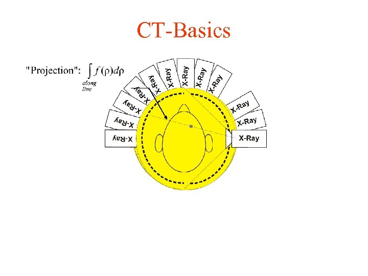CT-Basics 